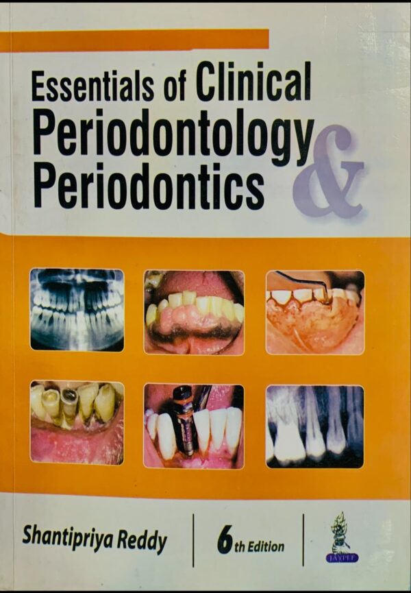 ESSENTIALS OF CLINICAL PERIODONTOLOGY &  PERIODONTICS  BY SHANTIPRIYA REDDY 6TH EDITION JYPEE PUBLISHERS