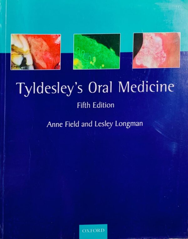 TYLDESLEY’S ORAL MEDICINE  5TH EDITION  BY ANNE & LESLEY